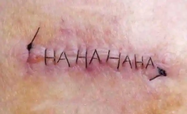 Nurse In Stitches