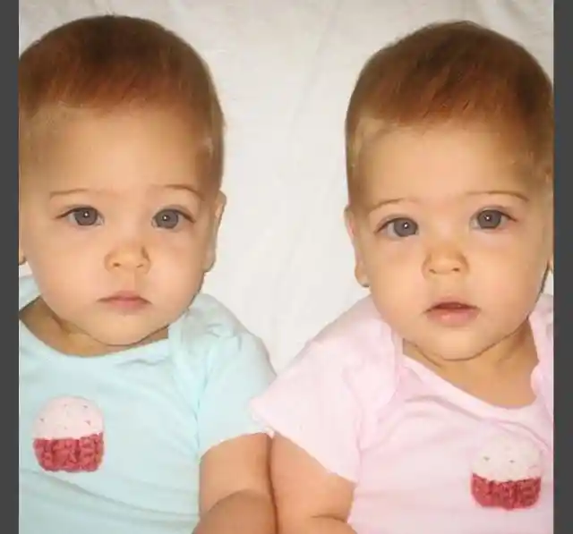 9 Years Ago They Were Called The World's Most Beautiful Twins – Now Look At Them