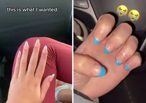 Weird-Looking Nails