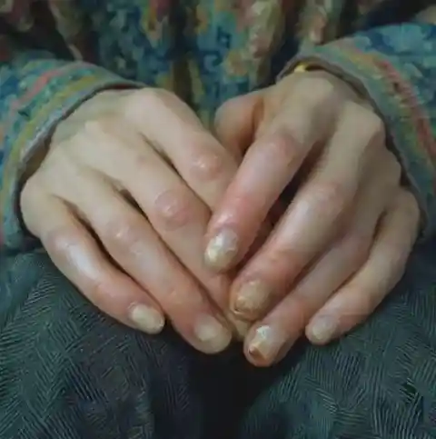 26. Wearing Acrylic Nails