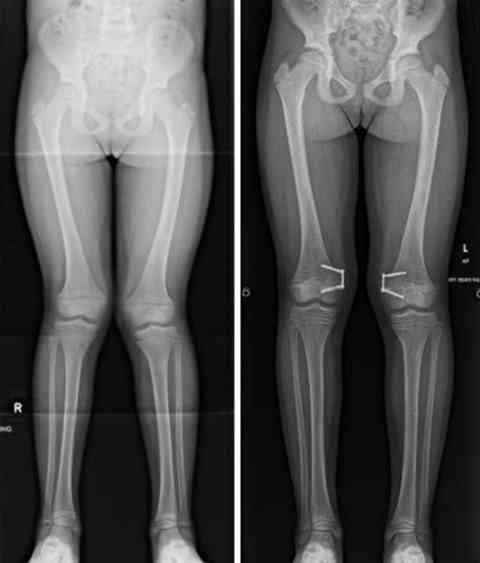 Before and After Surgery